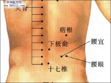 腰痛奇穴--痞根穴