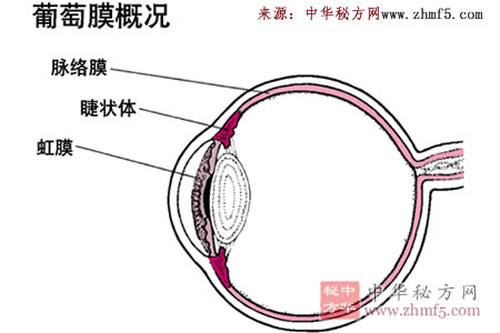 葡萄膜炎食疗配方7例