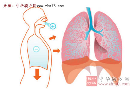 成人呼吸窘迫综合征(肺不张)